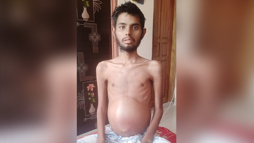 ব্লাড ক্যান্সারে আক্রান্ত মো. রনি। ছবি: সংগৃহীত