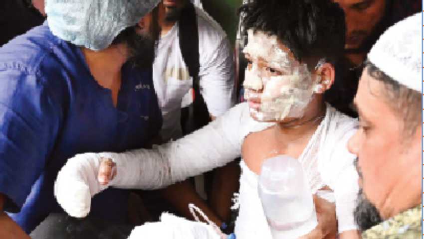 রোগী-স্বজনদের আহাজারিতে ভারী বার্ন ইউনিটের বাতাস 