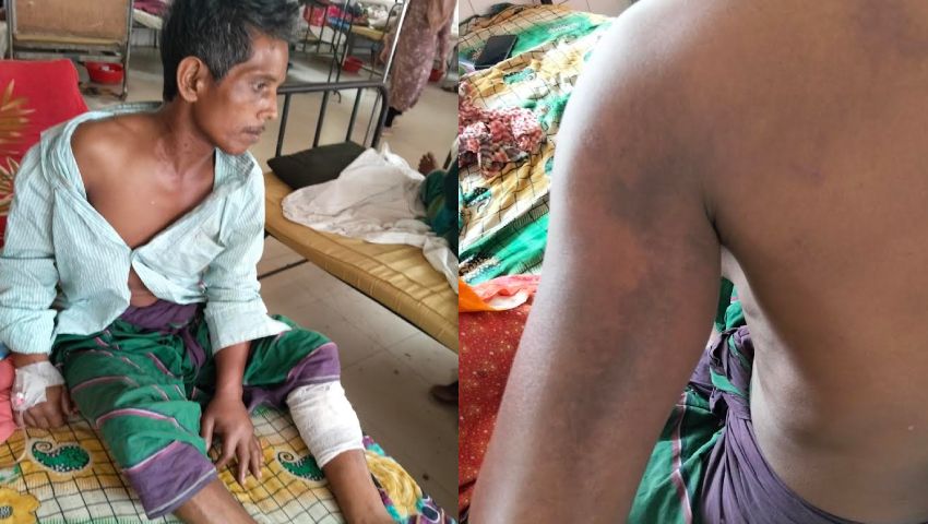 ডাব ব্যবসায়ীকে মারধর করে টাকা-মোবাইল ছিনতাই