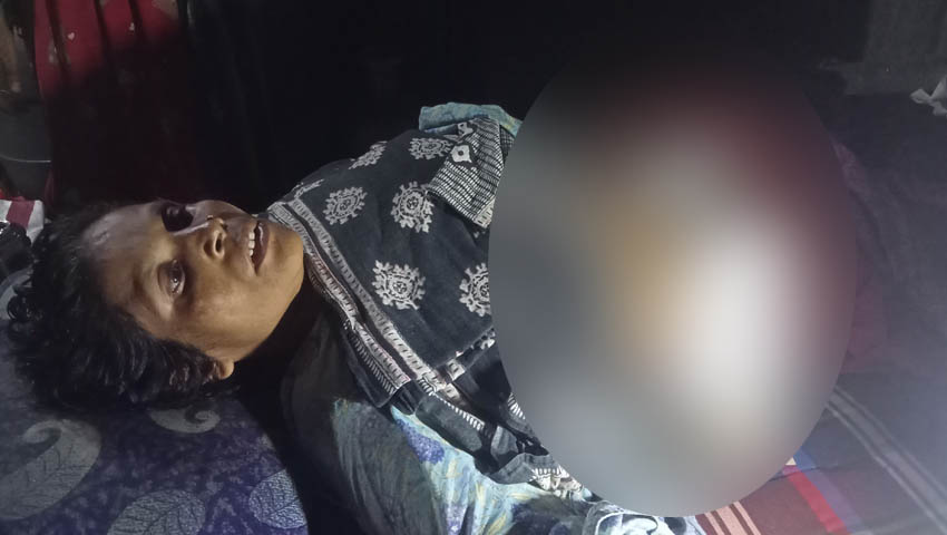 অর্থাভাবে চিকিৎসা বন্ধ মুমূর্ষু রূপালী বেগমের